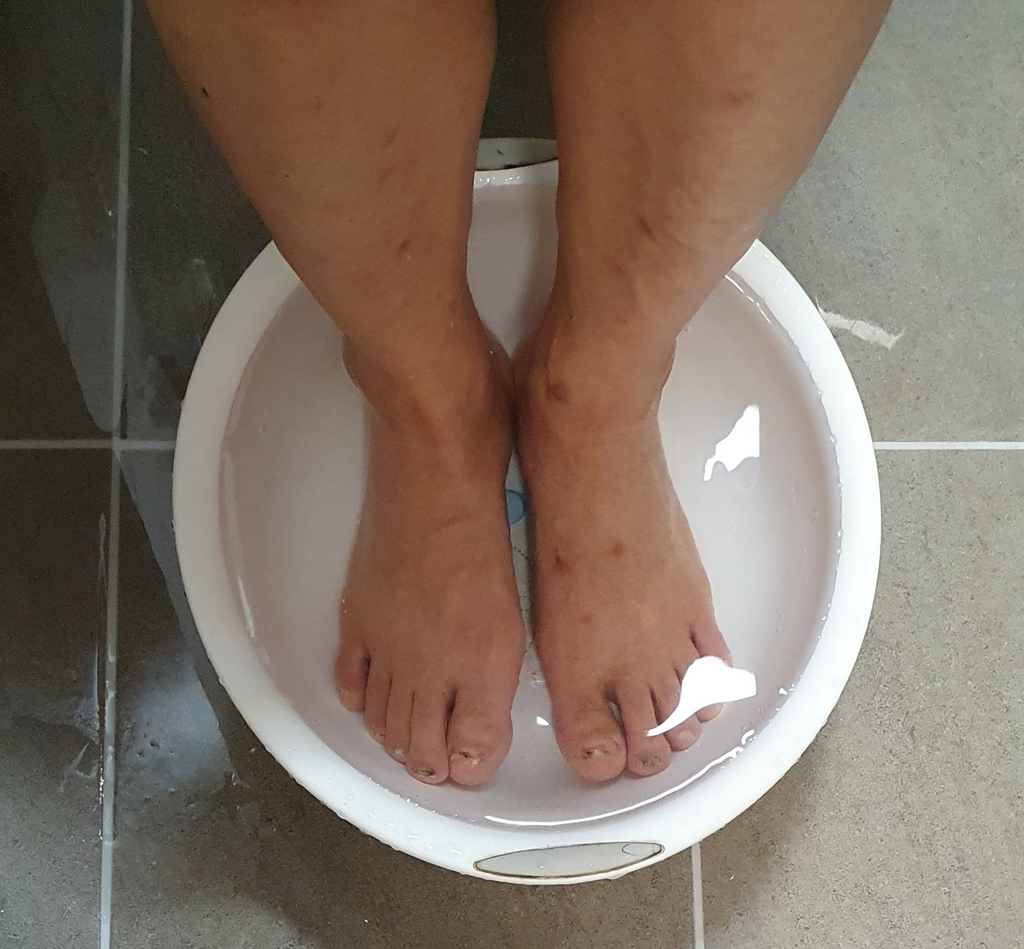 당뇨 환자 발 씻기와 물기 말리는 법: 절단의 위험을 막는 하루 10분 발 관리 실천법 1 image 21