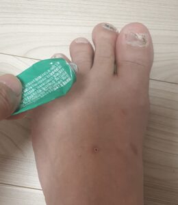 당뇨 발 무좀, 약 부작용이 두려워 4년을 버틴 환자의 현실적인 발 관리 습관 가이드 7 발2